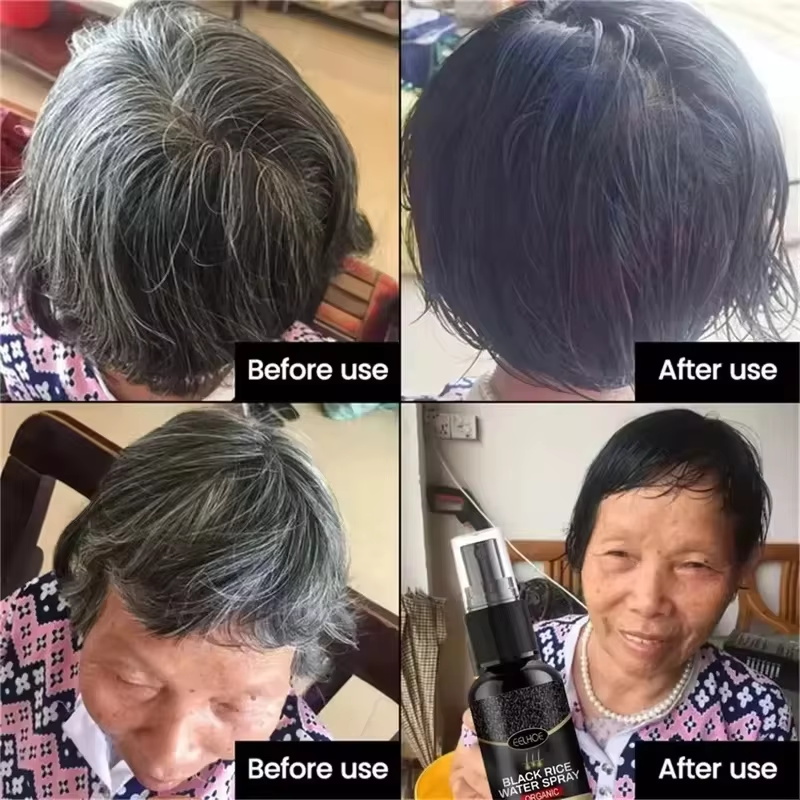 그레이 화이트 헤어 트리트먼트 세럼, 흰머리를 검은색으 - Hair Care Ginseng 리뷰 및 가격