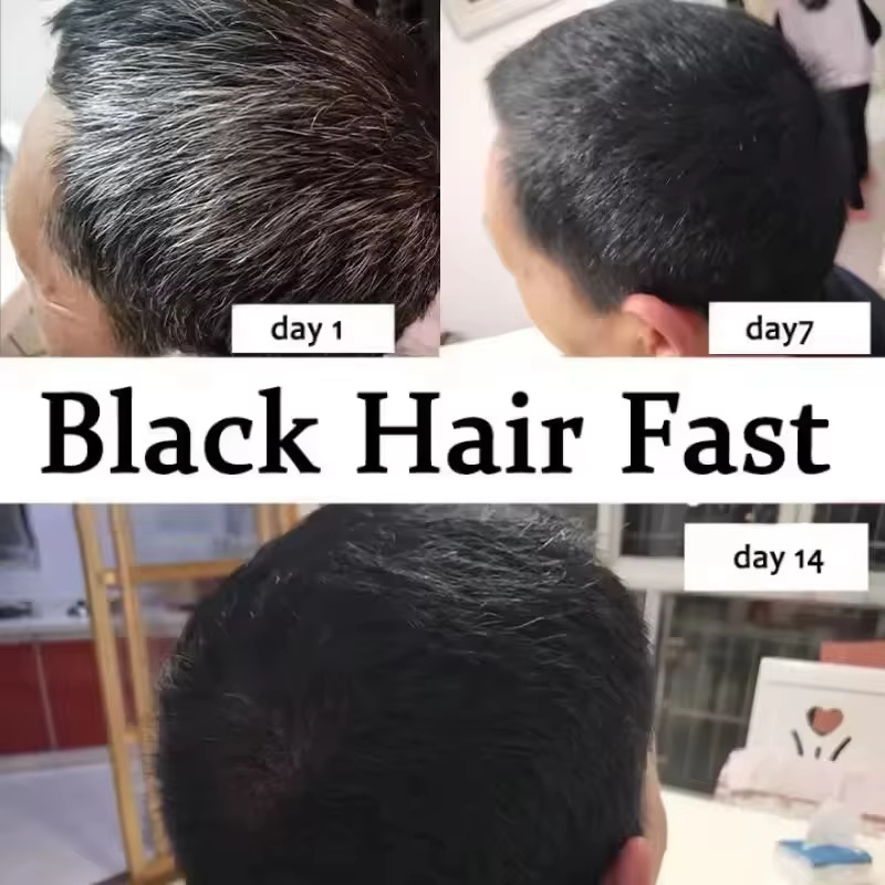 그레이 화이트 헤어 트리트먼트 세럼, 흰머리를 검은색으 - Hair Care Ginseng 리뷰 및 가격