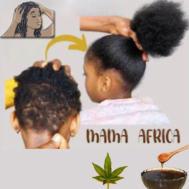아프리카 여성 견인 탈모증 치료 탈모 치료 가발 제거  - Hair Care Ginseng 리뷰 및 가격