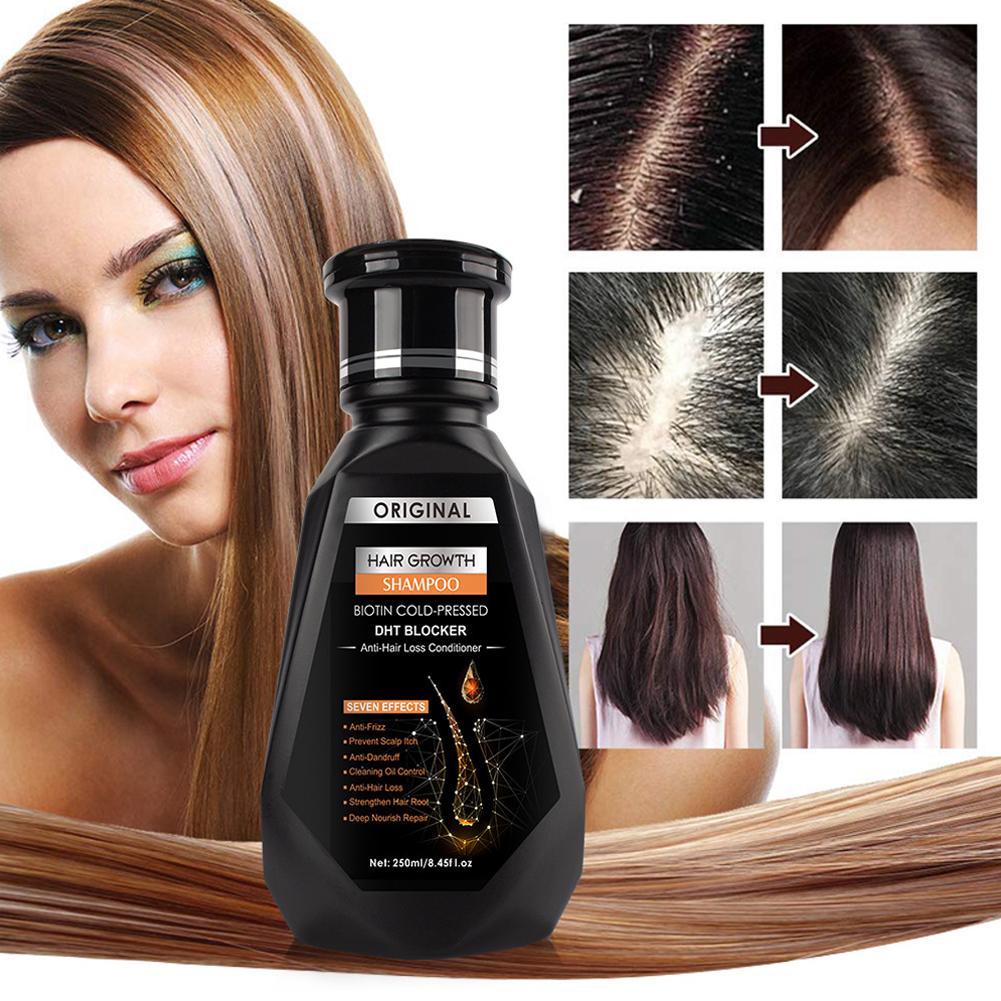 비오틴 생강 샴푸 두꺼워지는 포뮬러 탈모 방지 얇아지는 - Biotin Shampoo Thickening 리뷰 및 가격