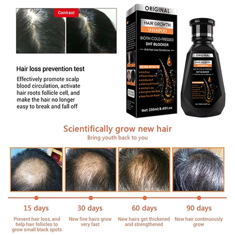 비오틴 생강 샴푸 두꺼워지는 포뮬러 탈모 방지 얇아지는 - Biotin Shampoo Thickening 리뷰 및 가격
